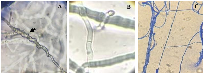 Control <em>in vitro</em> de <em>Neopestalotiopsis</em> sp. aislada de fresa empleando <em>Trichoderma</em> y fungicidas comerciales. Figura 6 - Mecanismos de parasitismo de <em>Trichoderma</em> sp frente a <em>Neopestaloptiopsis</em> sp. A) Enrollamiento, B) Formaci&oacute;n de ganchos y C) Adhesi&oacute;n y lisis.