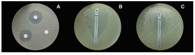 Diversidad y resistencia a antibióticos en bacterias asociadas a síntomas de infección bacteriana en cultivos de Costa Rica. Cuadro 3 - Géneros bacterianos identificados y frecuencia de bacterias resistentes a los antibióticos Estreptomicina (Estr), Tetraciclina (Tetra) y Gentamicina (Gent).