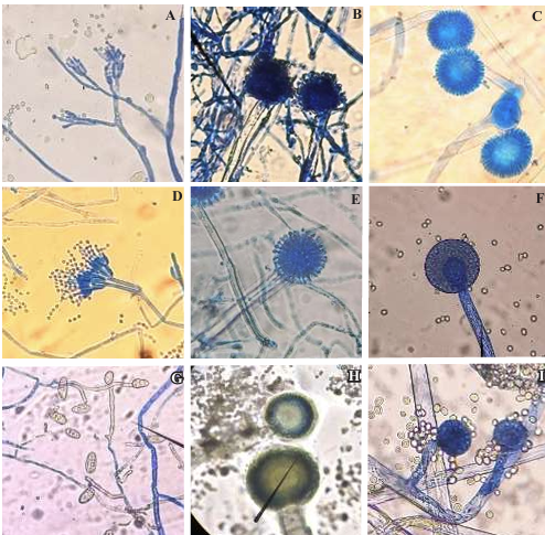 Antifungal effect of clove essential oil and its main components on fungi isolated from corn tortillas. Figure 1 - Fungal structure by optic microscopy (40X), isolated from corn tortillas from Morelia, Mich (A: <em>Penicillium</em> sp. and F: <em>Mucor</em> sp.), Monterrey, N.L. (B: <em>Aspergillus</em> sp. and G: <em>Curvularia</em> sp.), Oaxaca, Oax (C: <em>Aspergillus</em> sp.), Hermosillo, Son (D: <em>Penicillium</em> sp. and H: <em>Aspergillus</em> sp.) and M&eacute;rida, Yuc (E: <em>Aspergillus</em> sp. and I: <em>Mucor</em> sp.).
