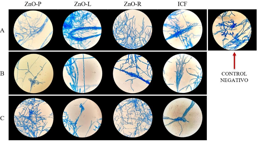 Antifungal activity using ZnO microparticles with different morphologies against <em>Rhizoctonia</em> sp.. Figure 5 - Microscopic Morphology of <em>Rhizoctonia</em> sp. on PDA Agar with Concentrations of A: 1000 ppm, B: 500 ppm, and C: 200 ppm of MPs; ZnO-P, ZnO-L, ZnO-R in comparison to ICF and the Negative Control after 7 days of growth. The optical microscope magnification was 40X. Lactophenol Blue.